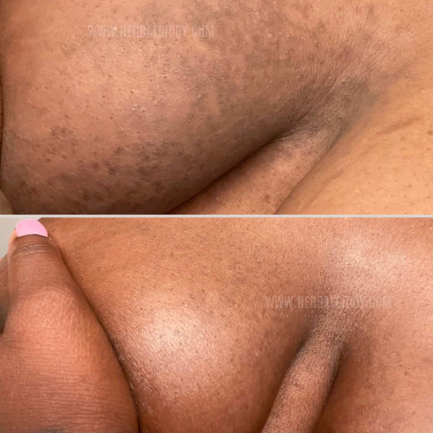 LIGHTENING BODY BUNDLE