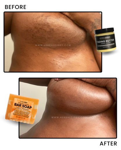 LIGHTENING BODY BUNDLE