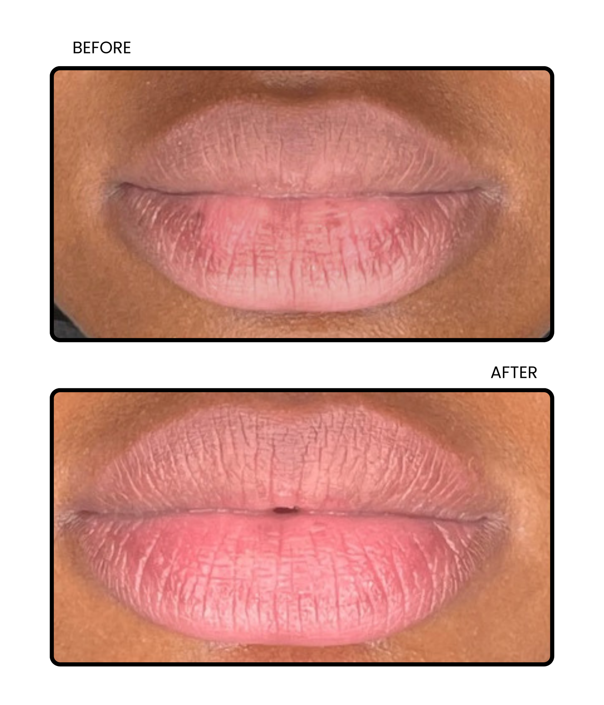 Turmeric Body Scrub results 2